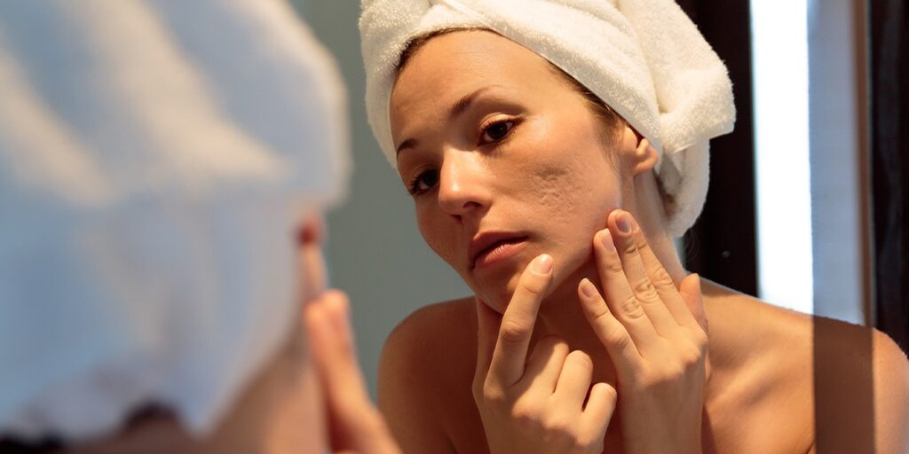 Woman with white towel wrapped around her head looking into a mirror with fingertips on her jawline